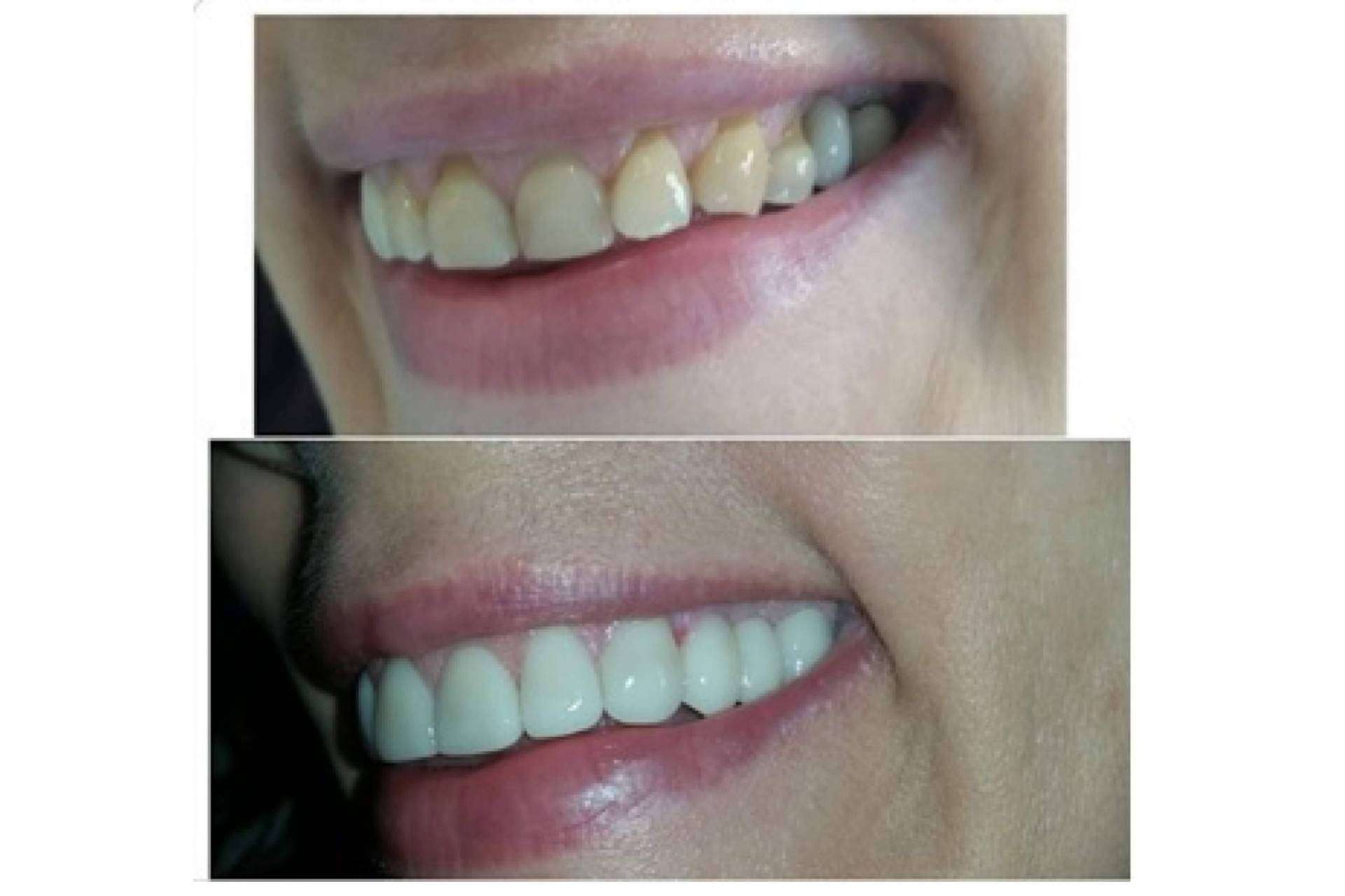 La halitosis puede ser una causa de divorcio