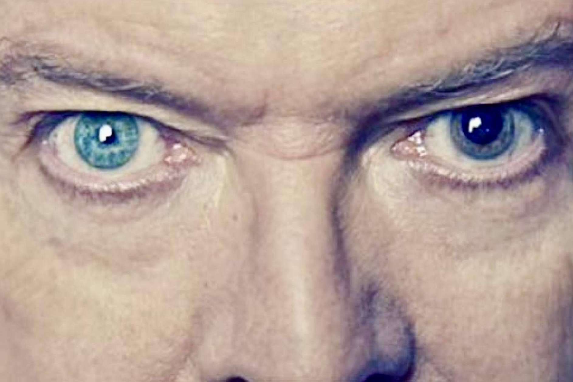 7 famosos que poseen heterocomía ocular según EyeCos