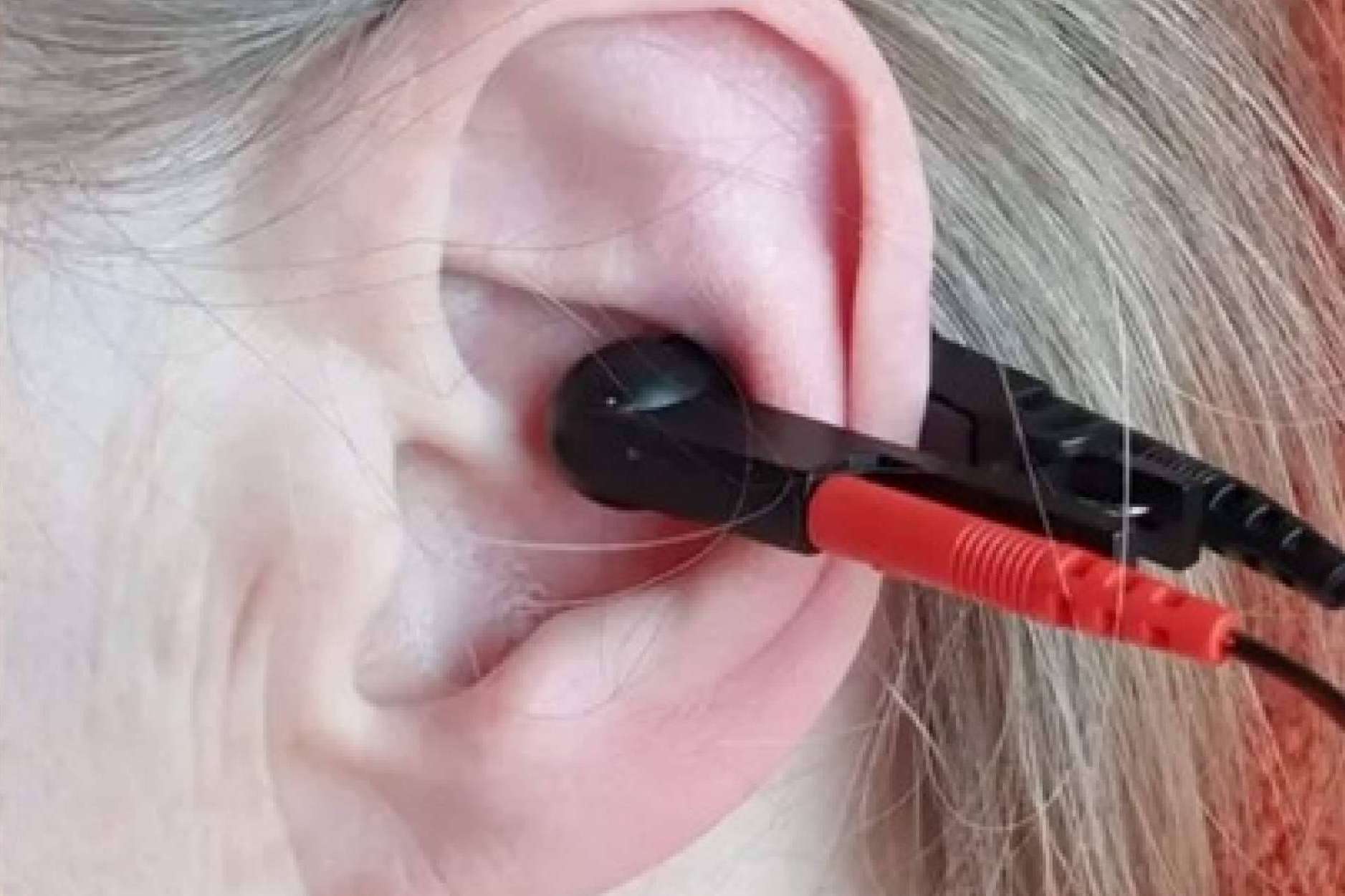 ALPERK, el nuevo horizonte de la neurorrehabilitación por GOGOA