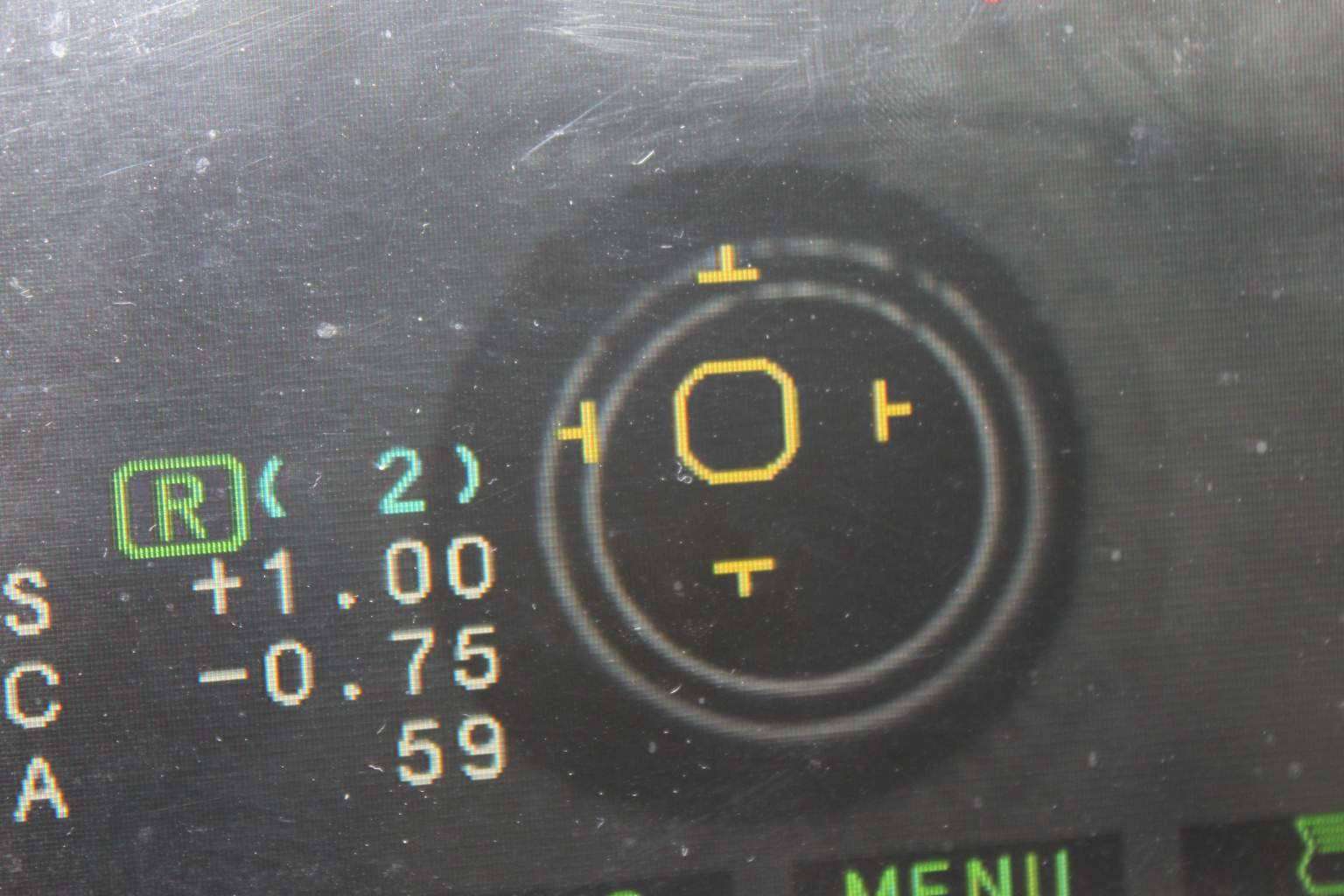 Cuidados con la vista a la hora de conducir grandes distancias este verano