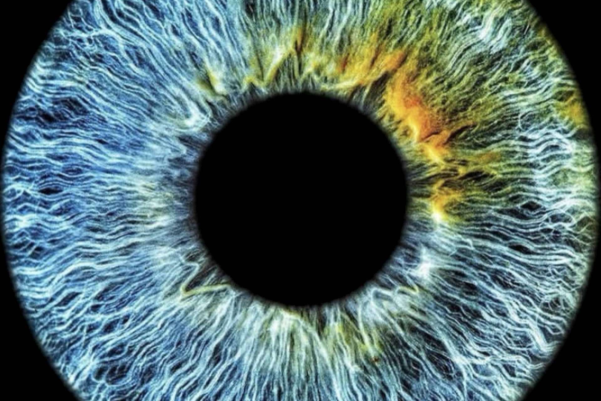 Láser 10G de Eyecos; la última tecnología para un cambio de color de ojos seguro y permanente