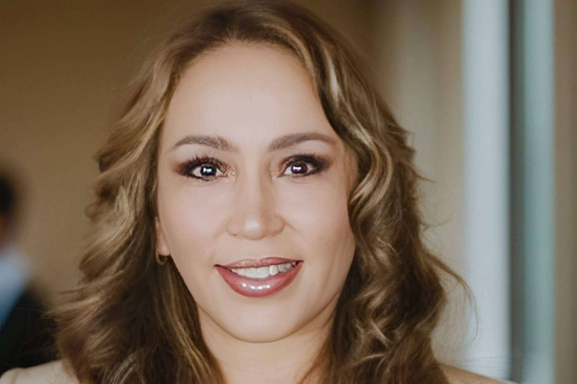 Acné hormonal como consecuencia del síndrome del ovario poliquístico y el exceso de vitamina B12, por la Dra. Janeth Arévalo