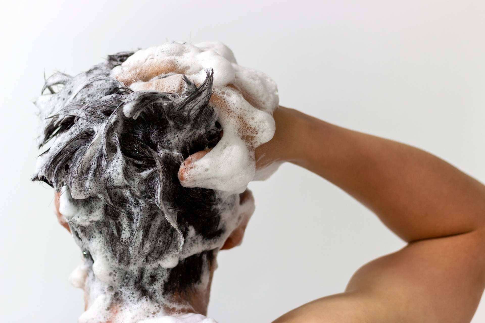 Pelo sin caspa y... ¿bonito? ¡Es posible!
