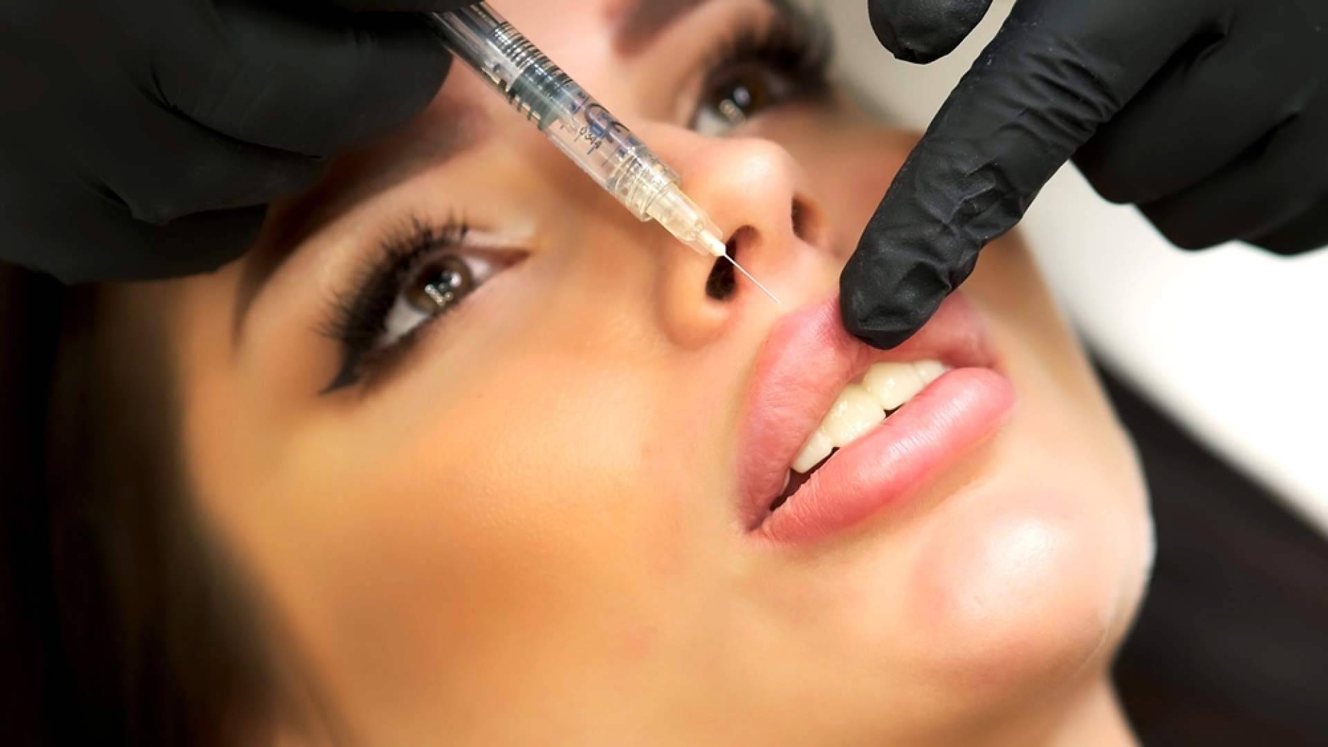 Labios con volumen natural gracias al relleno con ácido hialurónico de Centro Estetica el Pilar