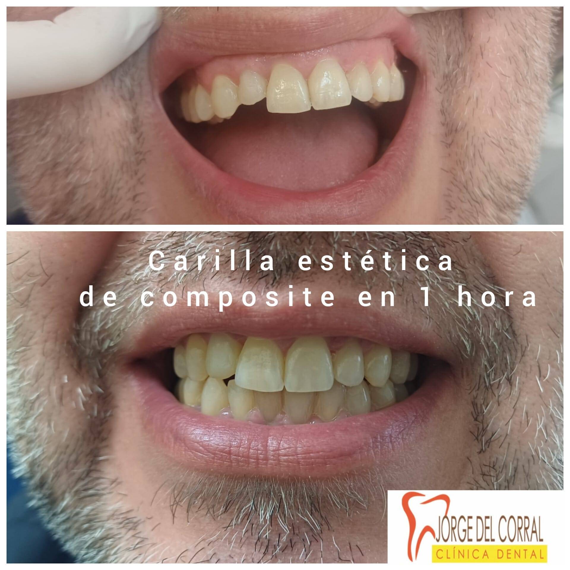 Jorge del Corral, la clínica dental que une calidad, precio y estética en Hortaleza