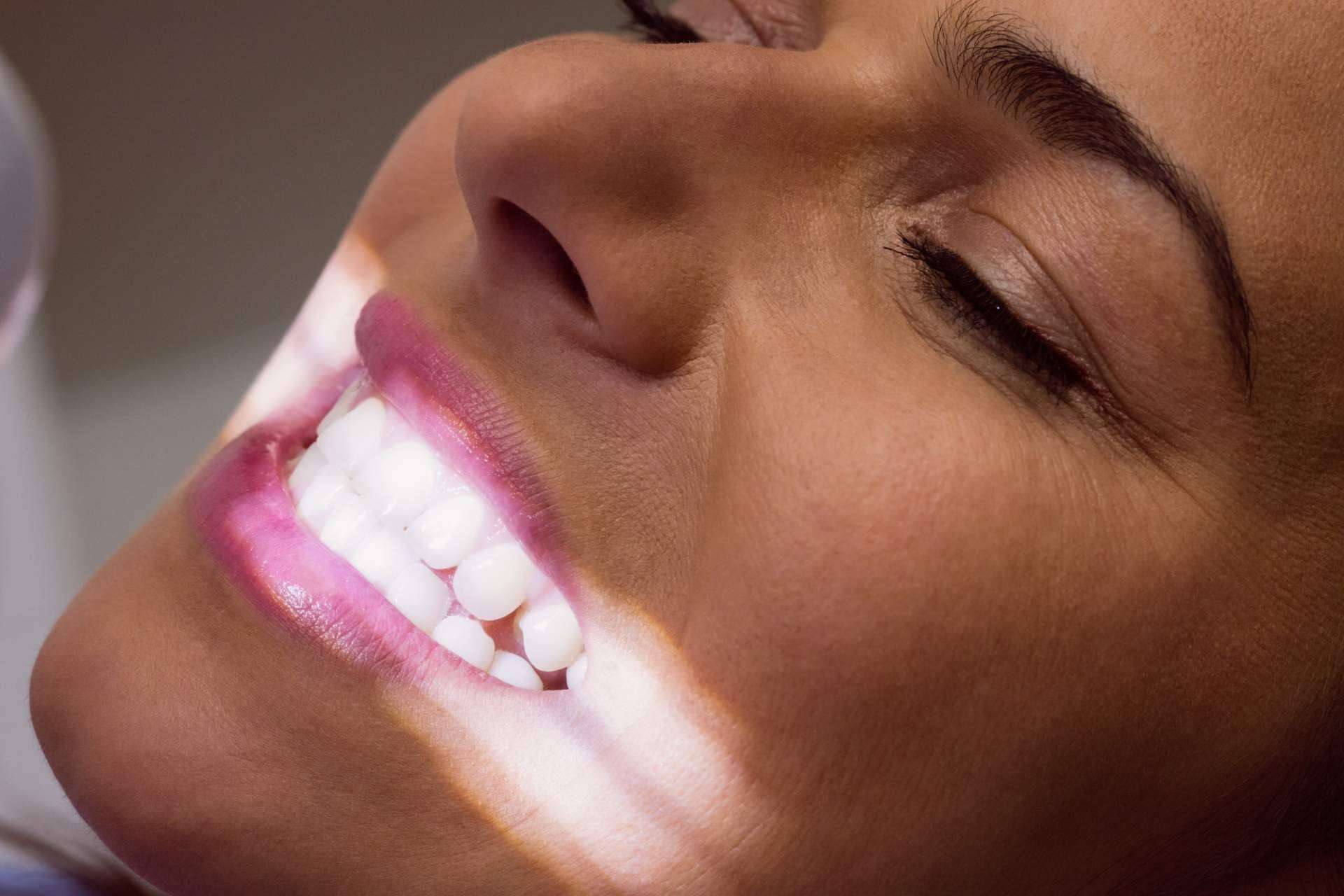El tratamiento de blanqueamiento dental LED con descuento especial en la Clínica Calvo De Mora en Madrid