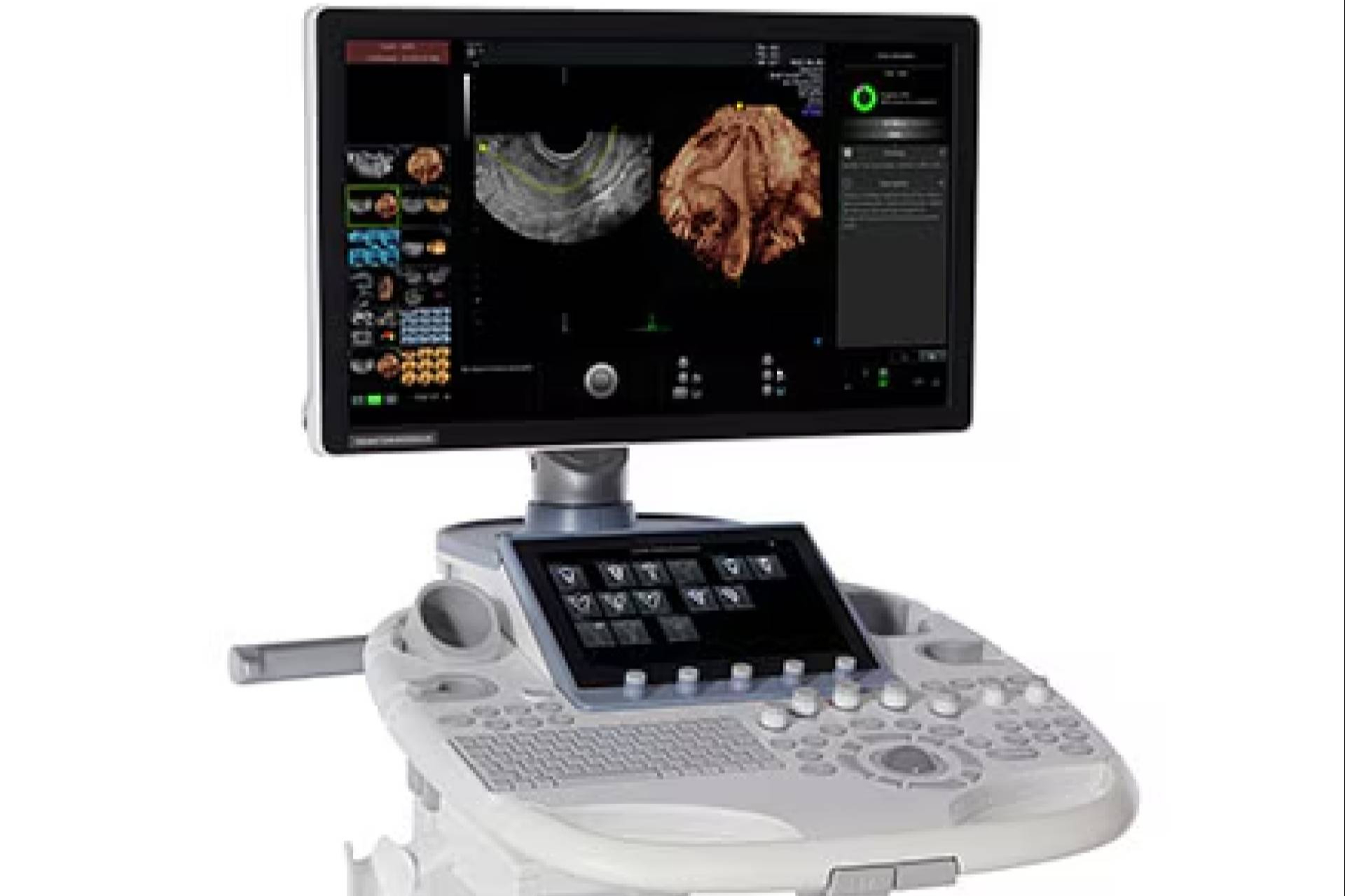 SCP Medical distribuye ecógrafos y equipos de imagen médica con garantía técnica en España