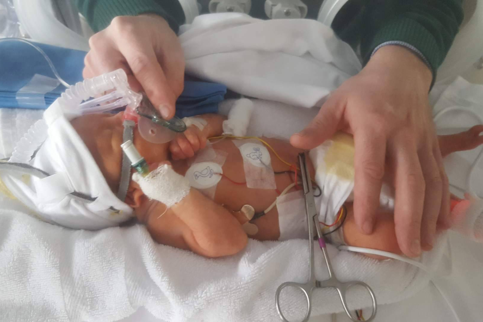 Cada bebé prematuro, una historia de lucha familiar en el Día Mundial de la Prematuridad