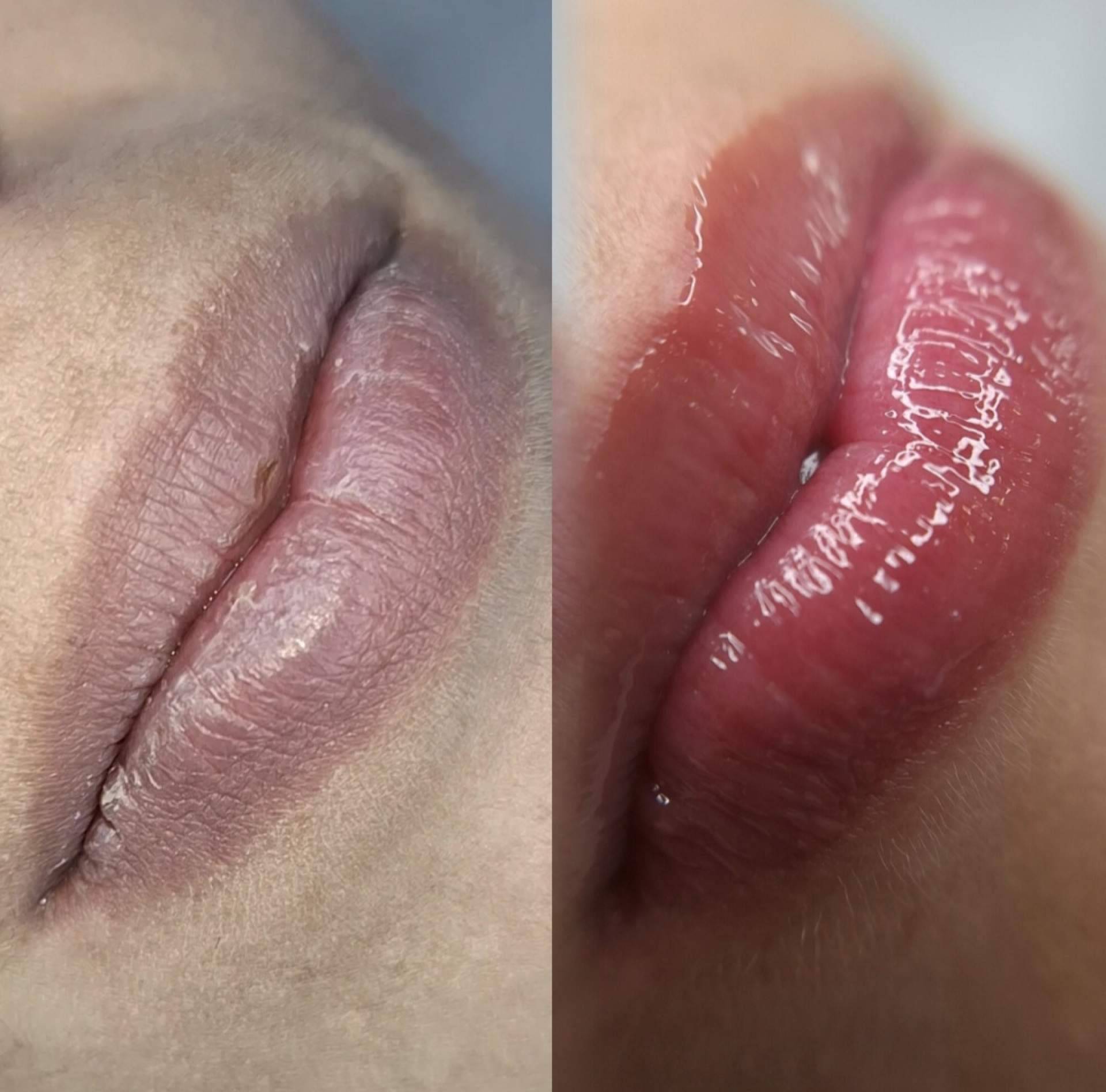 Estética Elena Santos impulsa un concepto integral de belleza con tratamientos personalizados