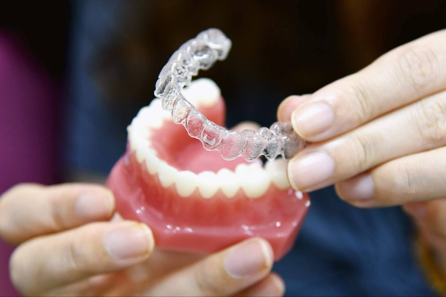 Invisalign precio Madrid; por qué Diamond Smile se consolida como clínica líder en ortodoncia invisible Madrid con una oferta desde 2.995 €