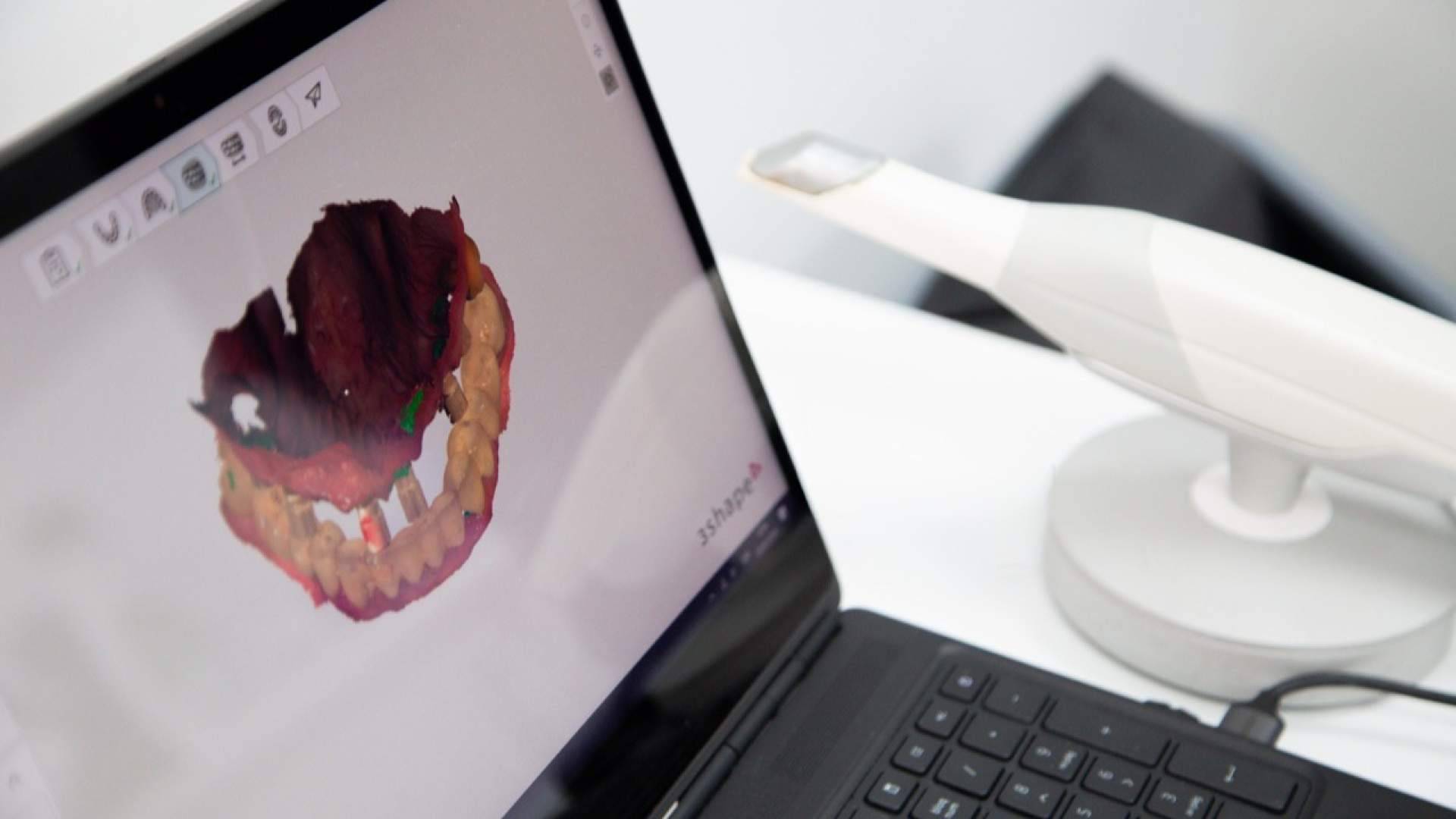 Sector Dental revoluciona los implantes dentales en Madrid por menos de 2€ al día