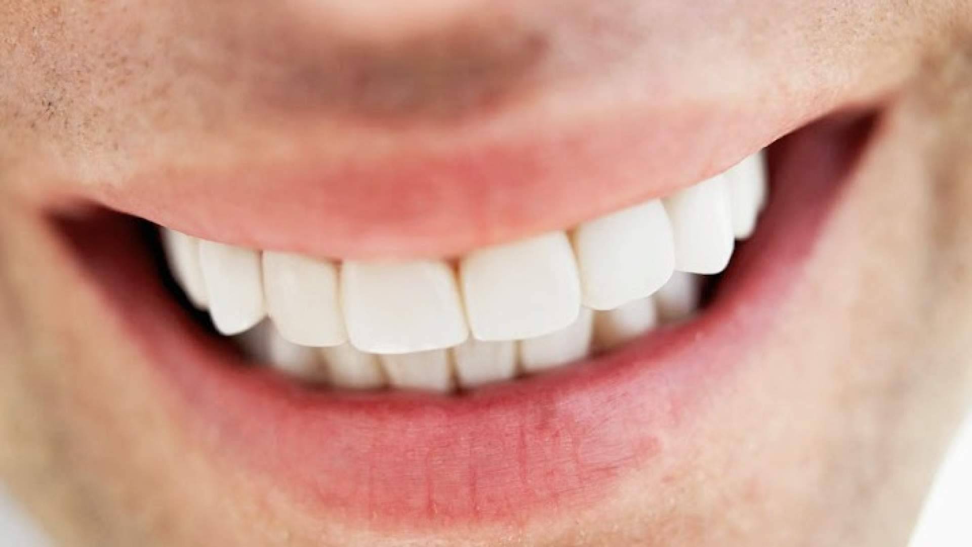 Clínica Dental Jorge del Corral impulsa la estética dental con carillas y prótesis fija de cerámica sin metal